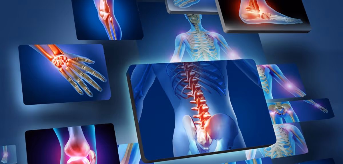 Beyond the Ache: Mastering Musculoskeletal Inflammation