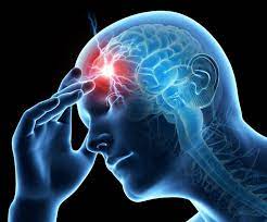 Photo of Concussion