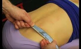 Photo of IASTM of the Spine