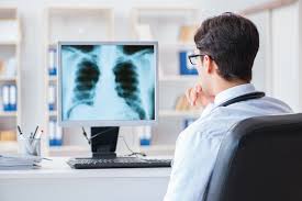Photo of doctor looking at an xray.
