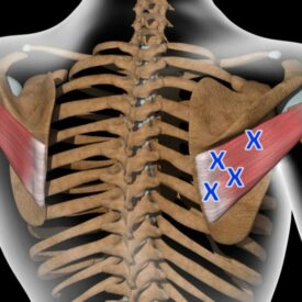 pic of trigger points of thoracic spine