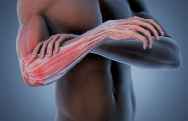 Elbow Trigger Points
