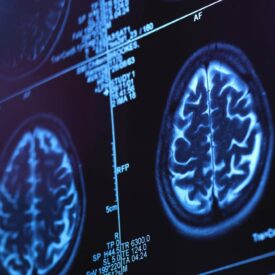 Alzheimer's and dementia training