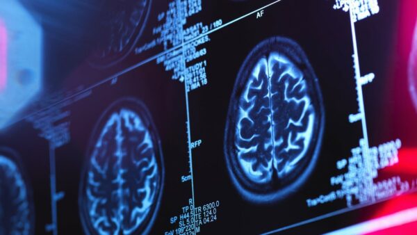 Alzheimer's and dementia training