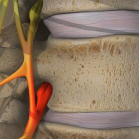 Chiropractic Continuing Education Subluxation pic